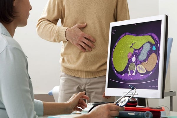 Signos de Alerta Temprana del Cáncer de Estómago